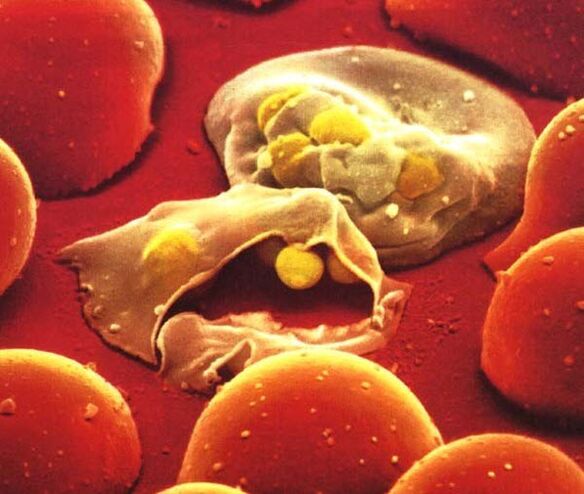 a legegyszerűbb malária plazmódium parazita