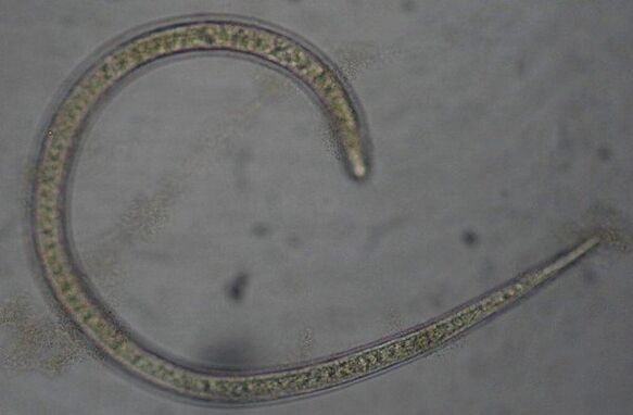 A trichinella egy protosztom, kerek parazita féreg