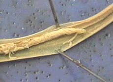 parazita